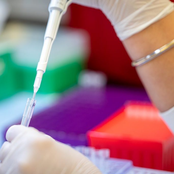 Scientist filling pipette
