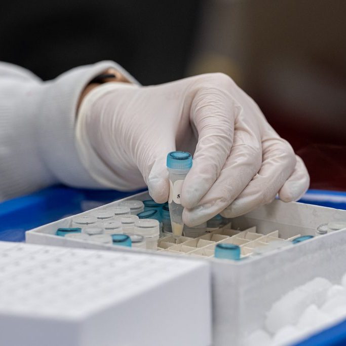 Close up of scientist working with vials